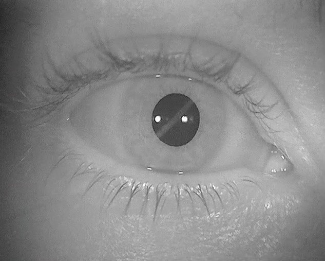GIF oeil